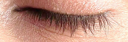 Wimpern vor der Anwendung, Tag 0